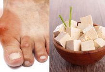 Giải đáp: Người bị bệnh gút có ăn được đậu phụ không?