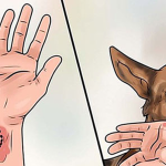 Khi bị chó cắn, bạn cần thực hiện ngay những việc sau để tránh nguy hiểm tính mạng